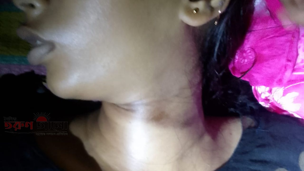 রায়গঞ্জে মাদ্রাসা পড়ুয়া ছাত্রীর আত্মহত্যা। 